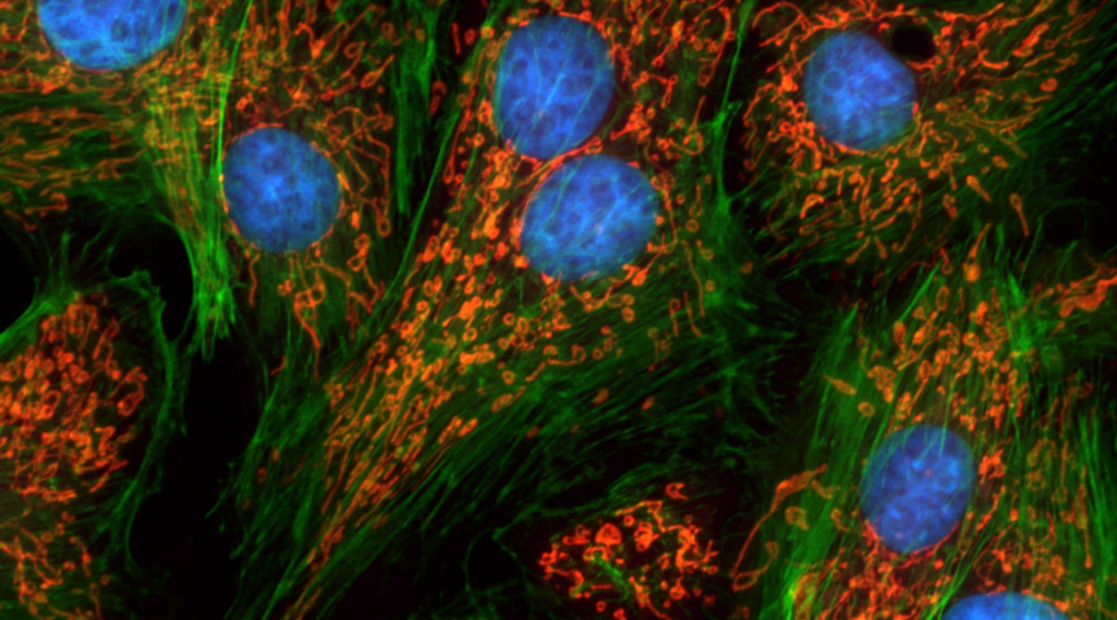 Endothelial Nox2 limits systemic inflammation and hypotension in endotoxemia by controlling expression of toll-like receptor 4